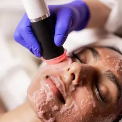 Oxygeno facial