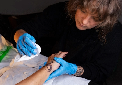 Tattoo Removal