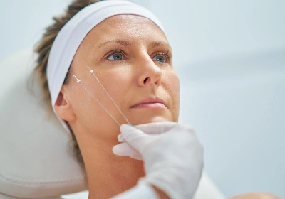 Threadlift