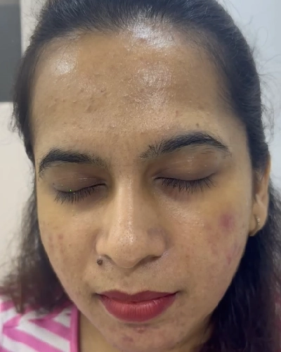 Skin Care