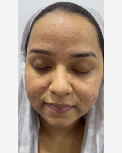 Skin Care