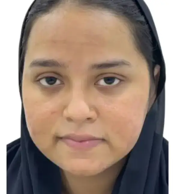 after treatment